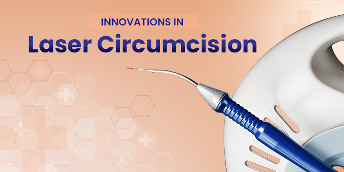 Innovations in Laser Circumcision: What’s New?